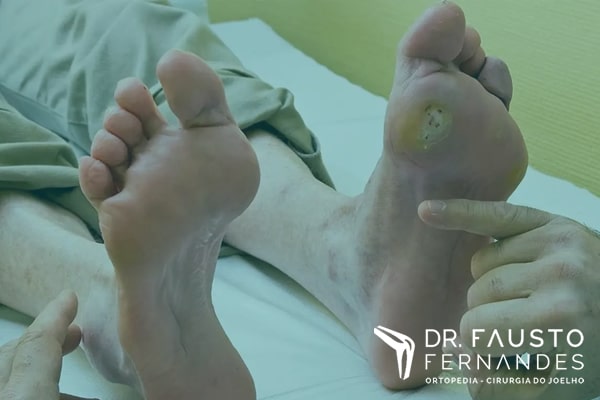 Pé diabético, o que é e como tratar